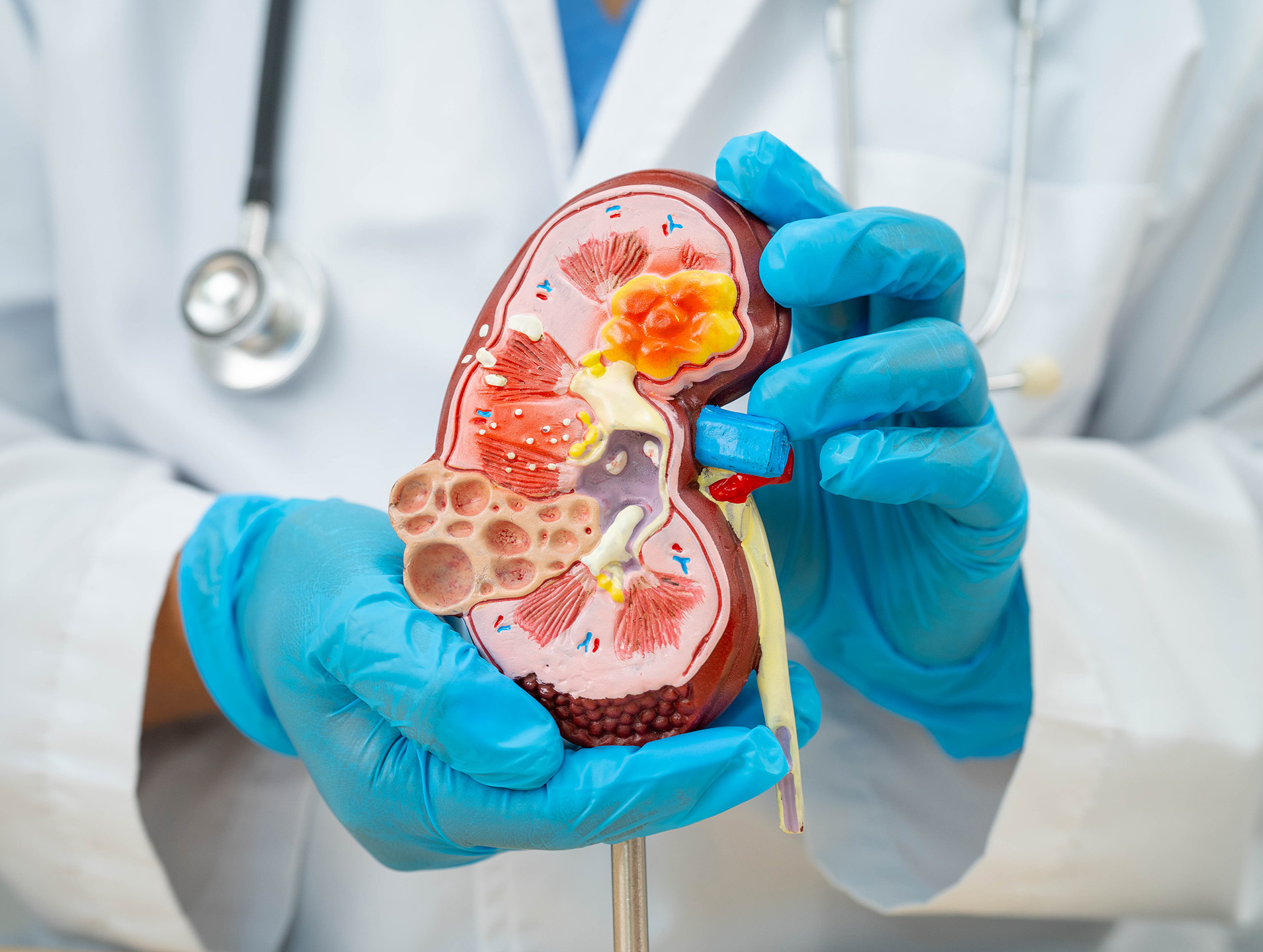Nephrology