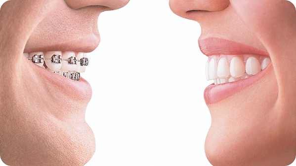 World-Class Orthodontics at Polyclinic.ae